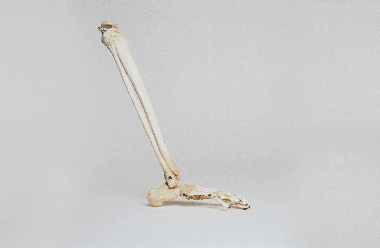 Tanezumab vs. NSAIDs for osteoarthritis Tanezumab vs. NSAIDs for osteoarthritis