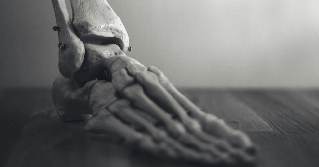 PRP for ankle osteoarthritis? PRP for ankle osteoarthritis?